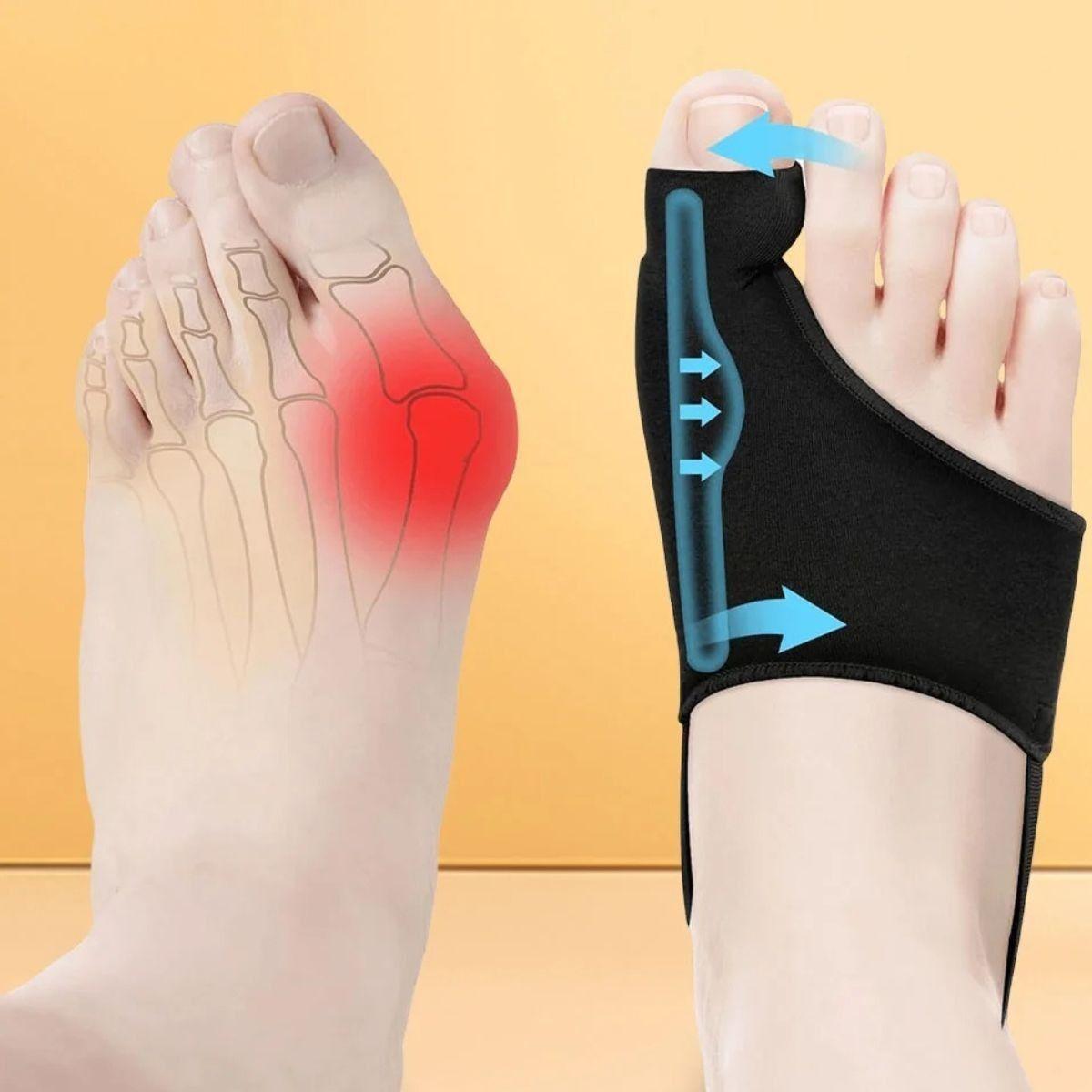 SET 8 PROTECTOR CORRECTOR ALISADOR DEDO MARTILLO GEL PIE LAU-3