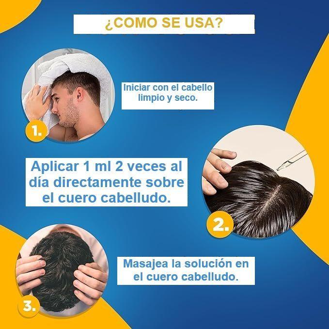 Minoxdil Kirkland 60ml Crecimiento Cabello Extrafuerte Usp5%-5