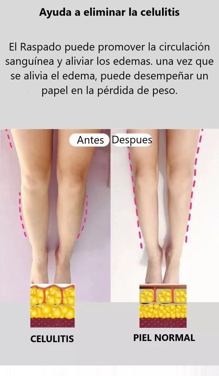 Masaje Terapia de Ventosas Termoterapia-Magnetoterapia-Infrarrojos-4