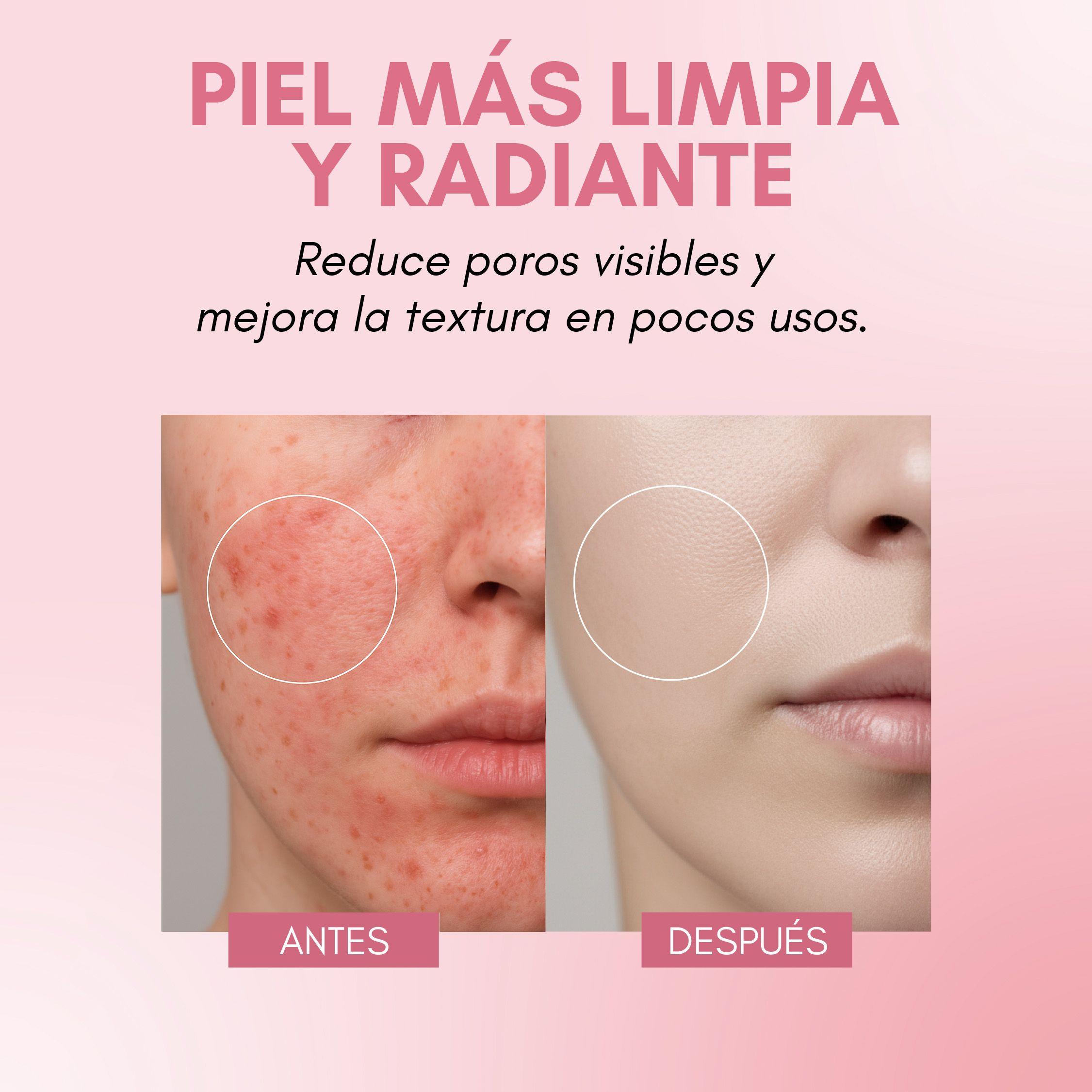 Mascarilla Limpieza Facial RebelSkin Pink and Clean-5