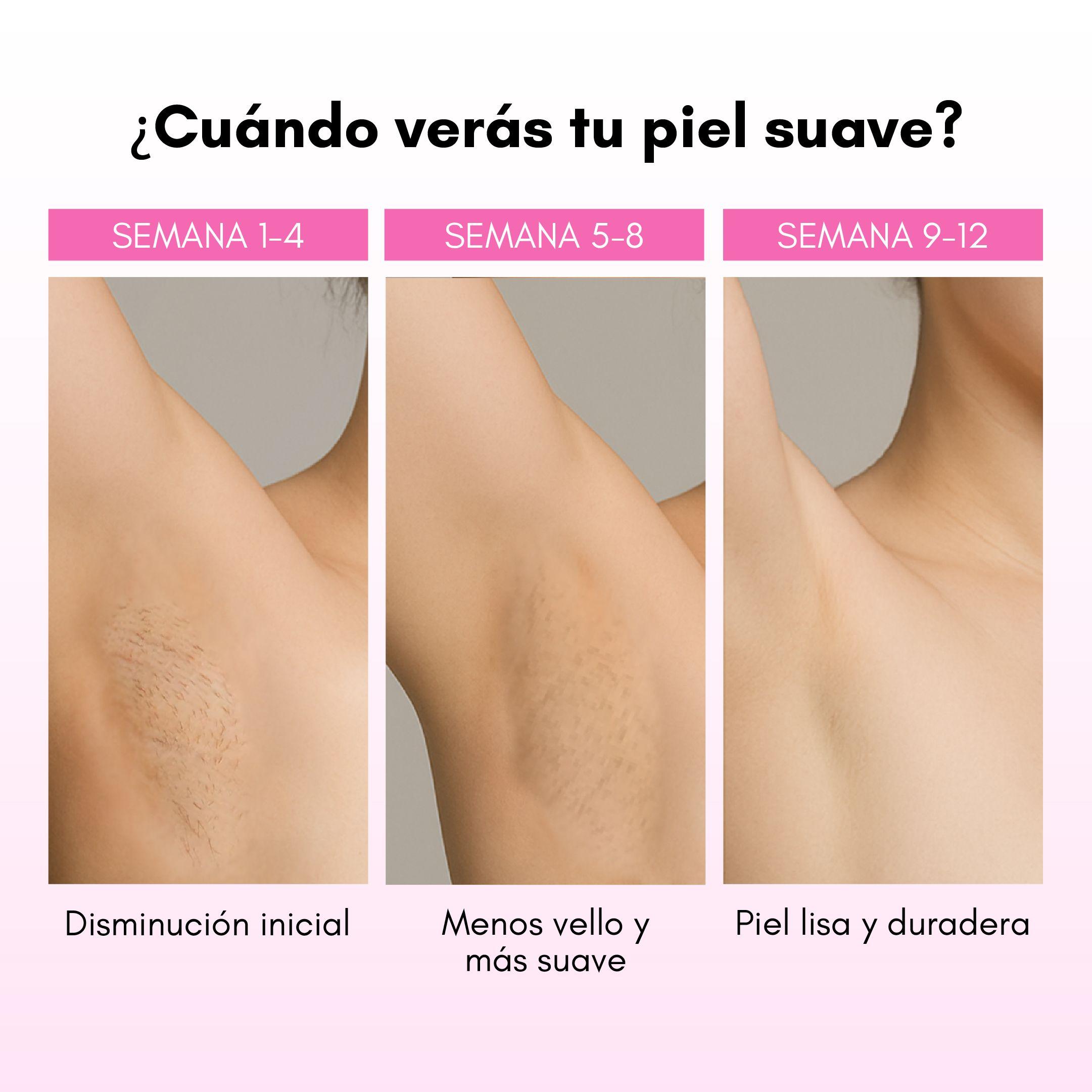 Depiladora Láser IPL RebelSkin-7