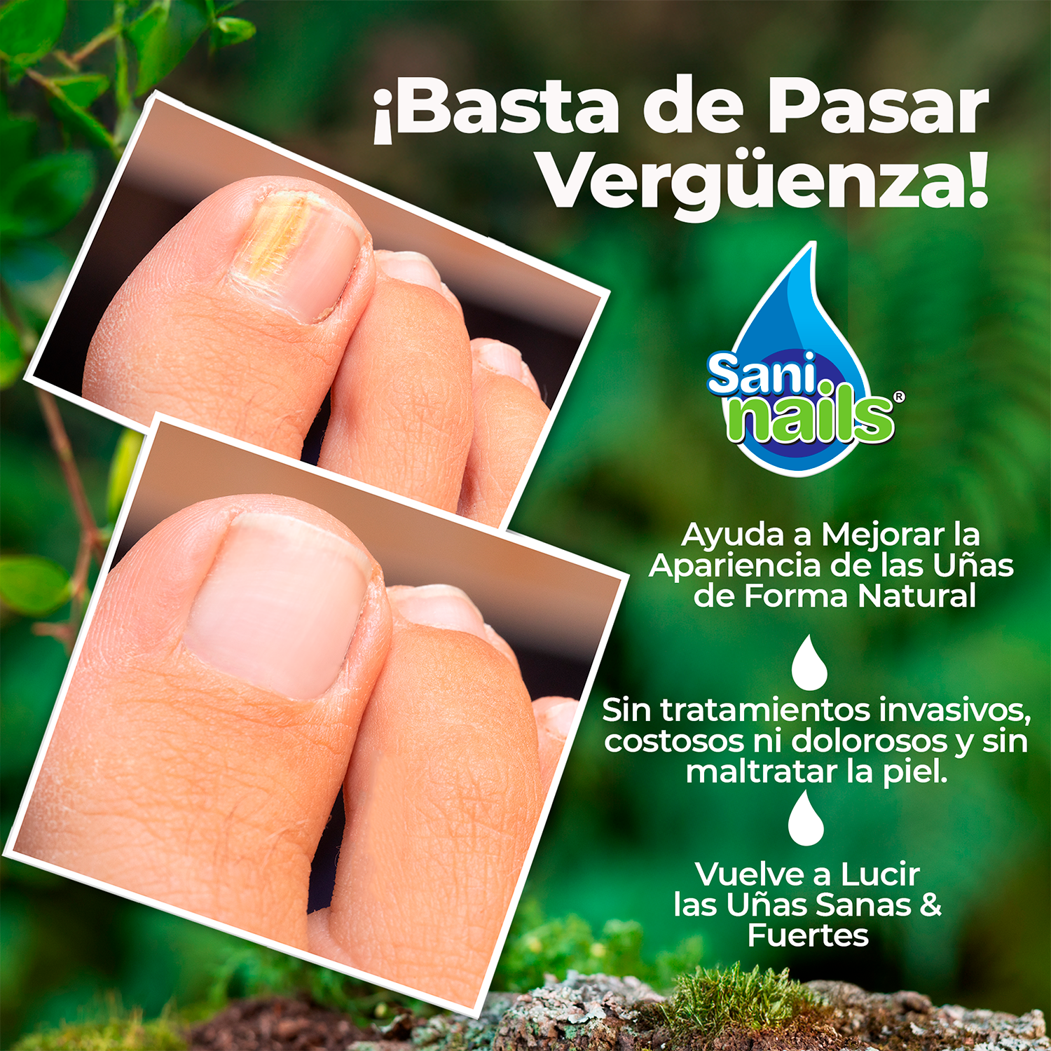 Sani Nails Ayuda a combatir los hongos de las uñas Pack 3x30 ml-6