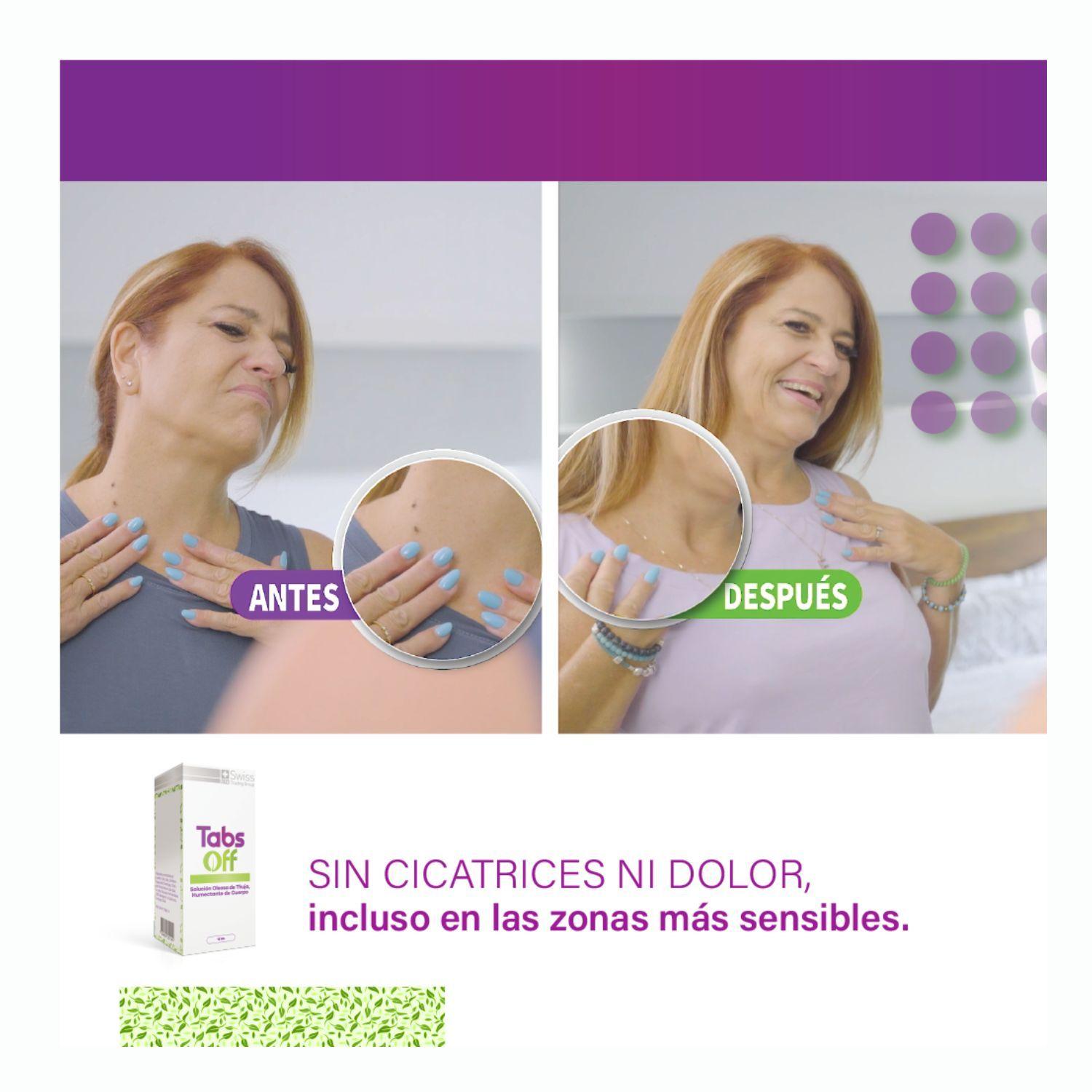 Tabs Off 2 Estuches Con Un Frasco De 15 Ml cada uno-3