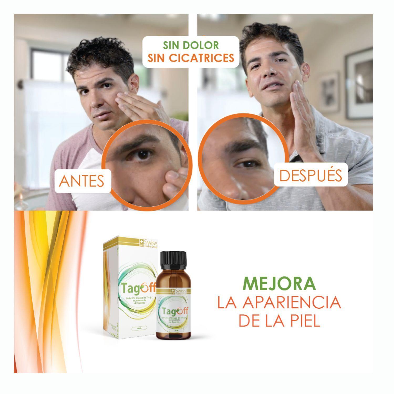 Tag Off 3 Estuches Con Un Frasco De 15 Ml cada uno-4