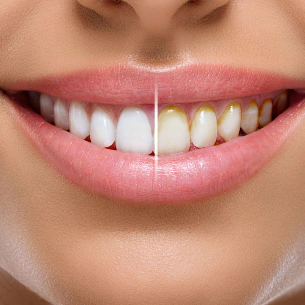 Miracle Smile Irrigador dental + 3 cabezales-5