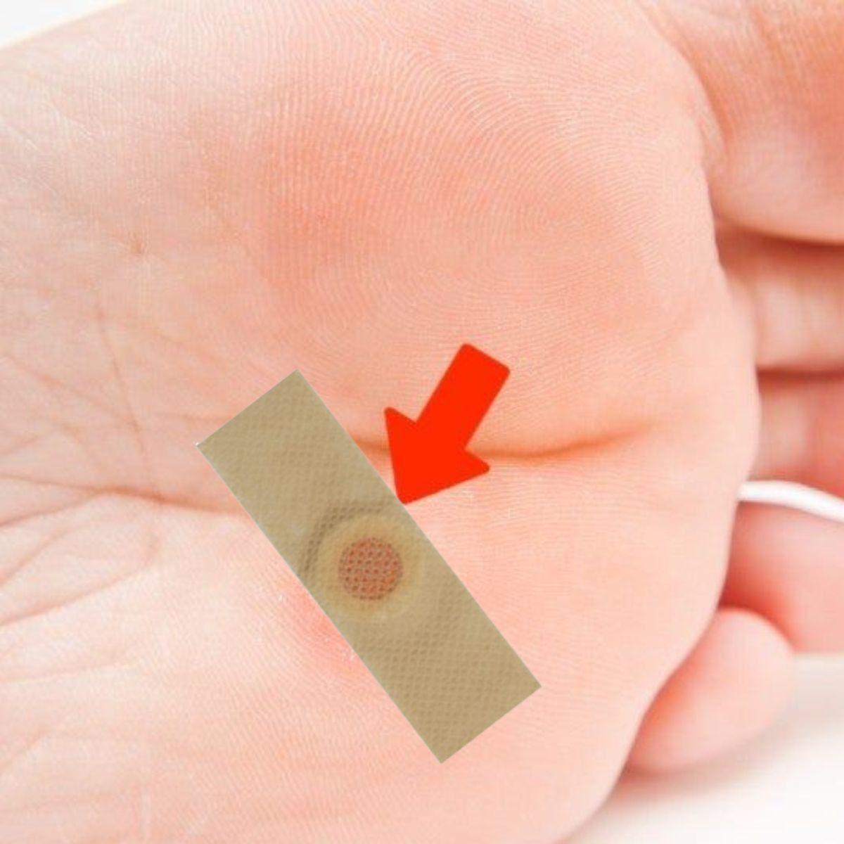 SET  7 PACK PARCHES REMOVEDOR DE CALLOS IMPUREZA ALIVIO LAU-6