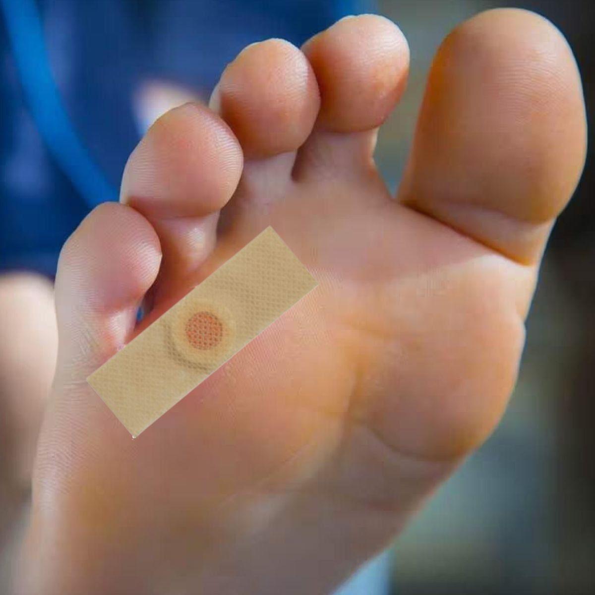 SET  7 PACK PARCHES REMOVEDOR DE CALLOS IMPUREZA ALIVIO LAU-7