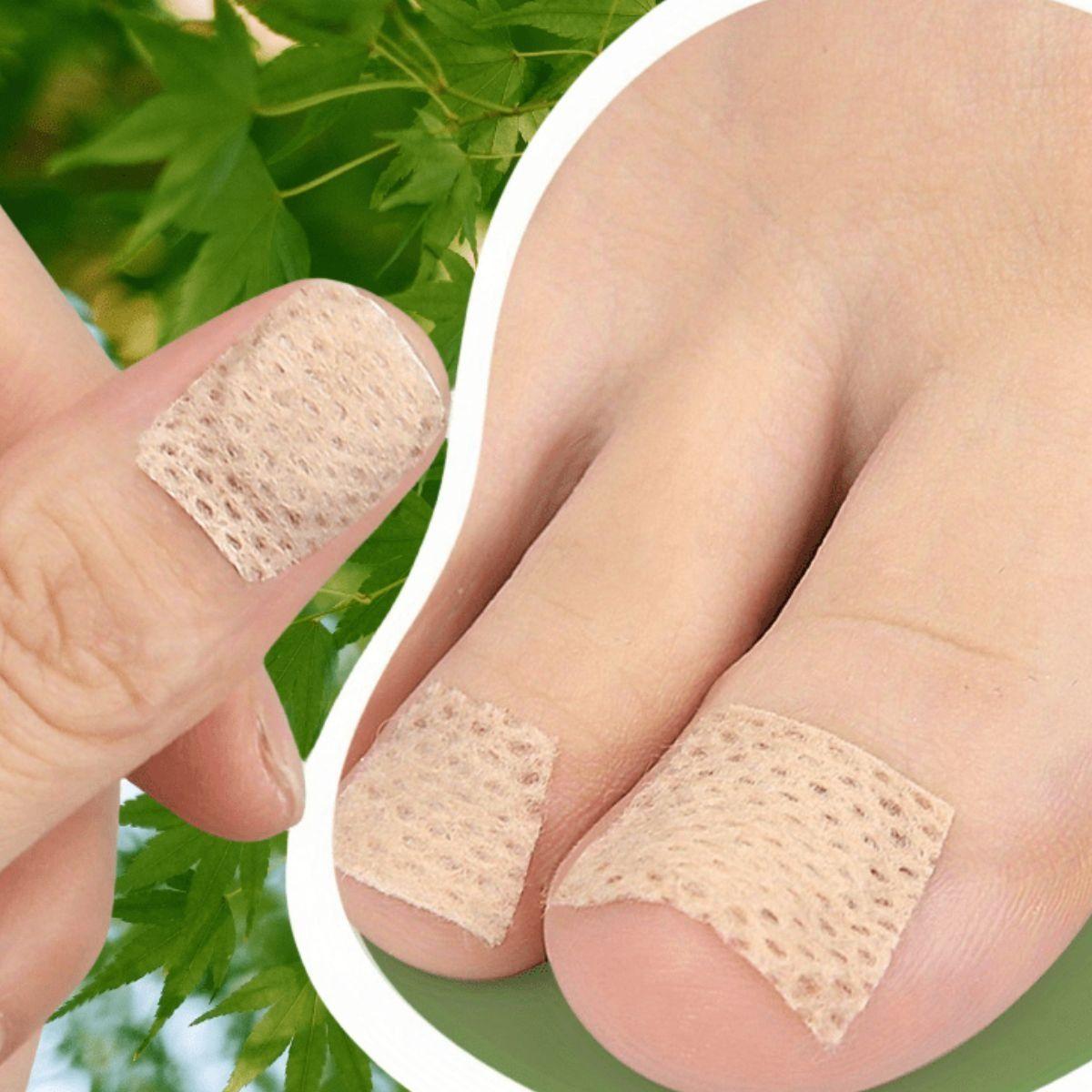 SET 5 PACK PARCHE PARA TRATAMIENTO UÑAS ANTIHONGOS LAU-8