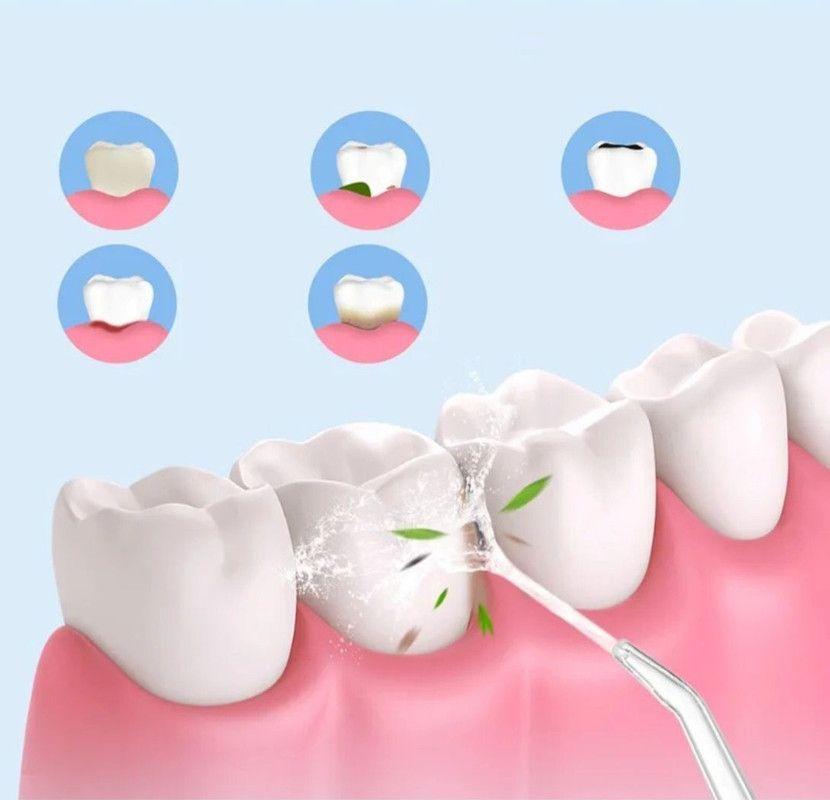 Irrigador Dental Bucal Limpieza Dientes Hilo Ultrasonico-3
