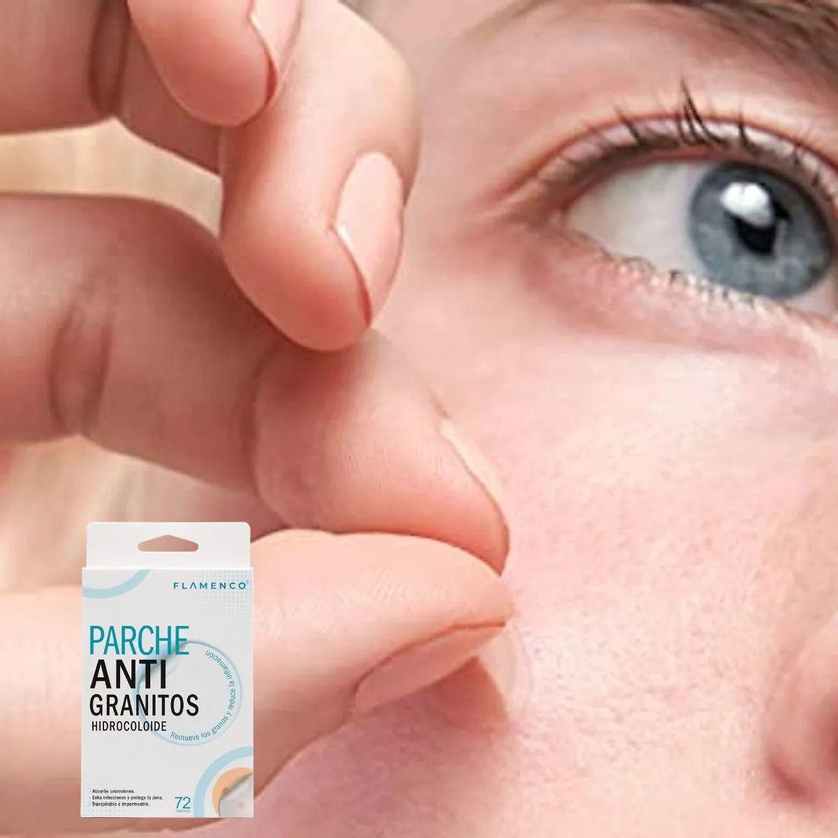 SET 2 MASCARA PARCHE FACIAL INVISIBLE ANTI-ACNE GRANOS LAU-3