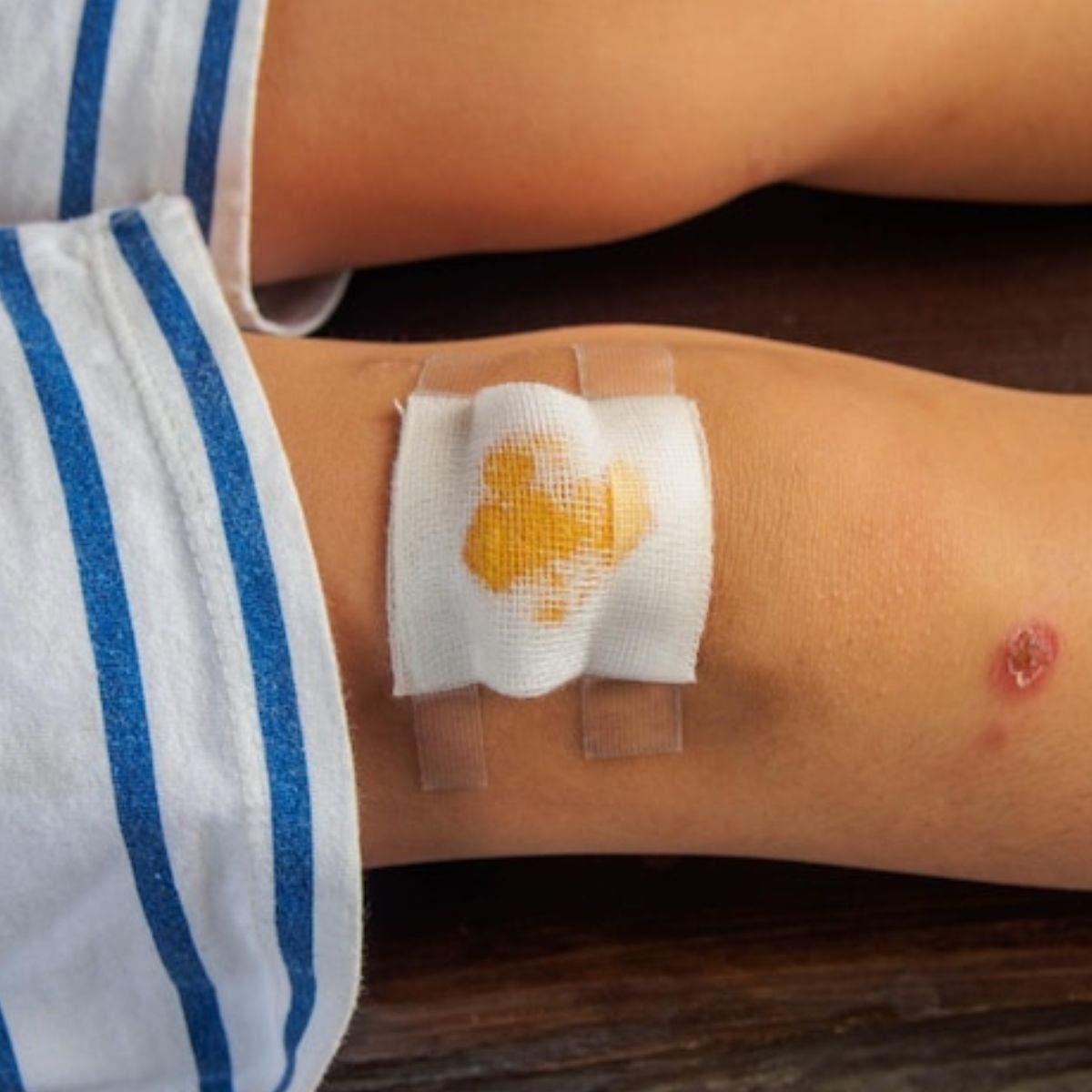 PACK 10 GASAS ESTERIL 90CMX45CM INSUMO MEDICO HERIDA LAU-2