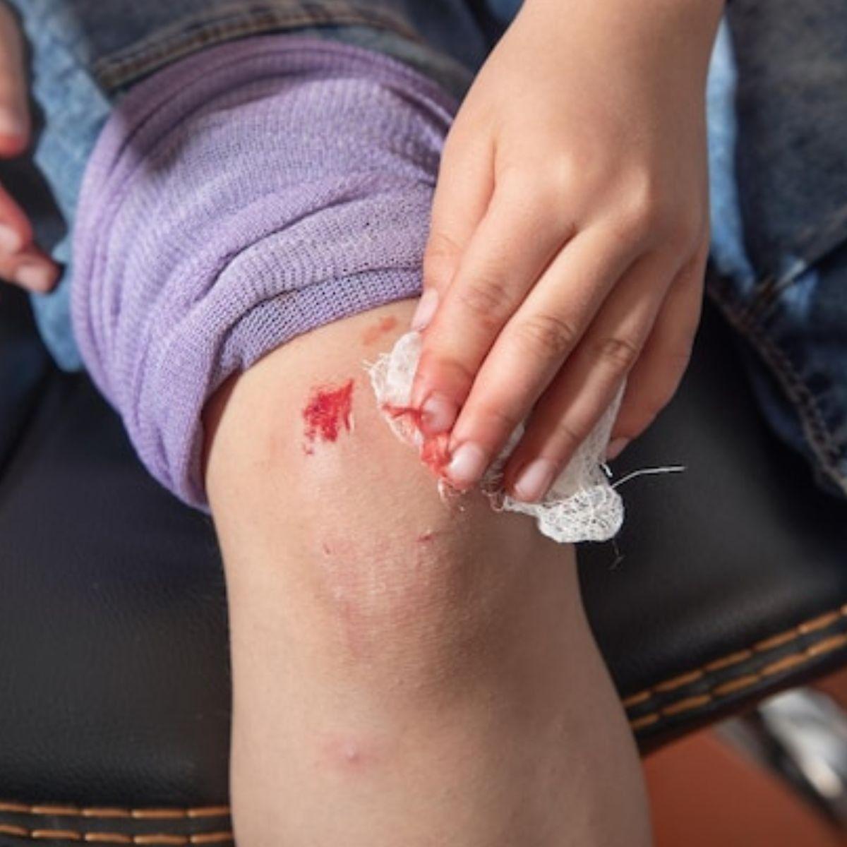 PACK 10 GASAS ESTERIL 90CMX45CM INSUMO MEDICO HERIDA LAU-6