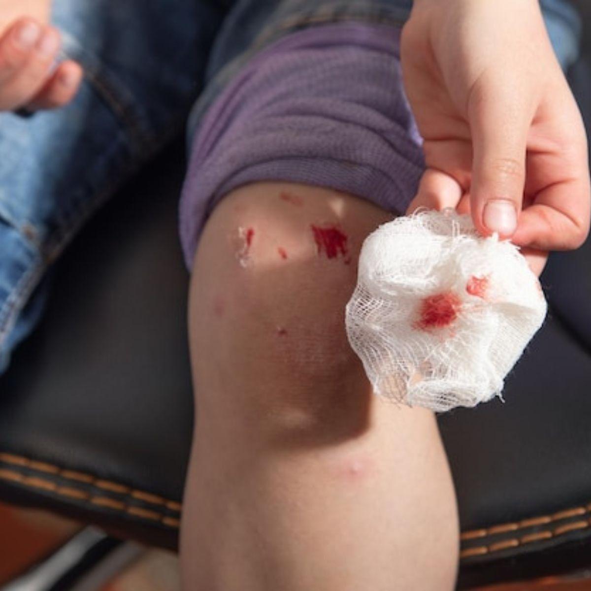 PACK 10 GASAS ESTERIL 90CMX45CM INSUMO MEDICO HERIDA LAU-7