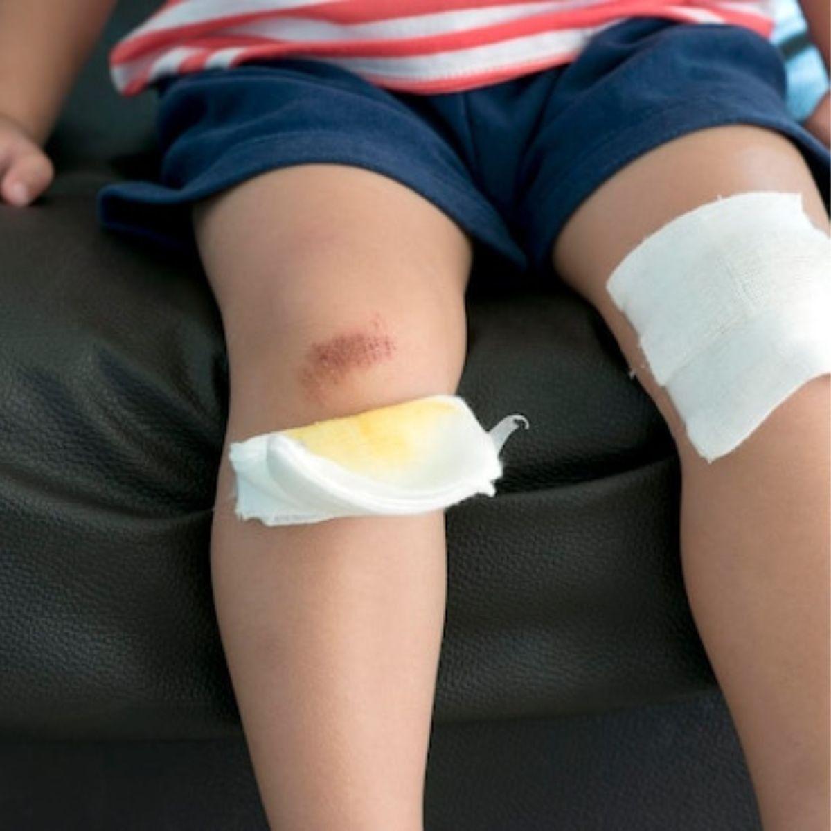 PACK 10 GASAS ESTERIL 90CMX45CM INSUMO MEDICO HERIDA LAU-9