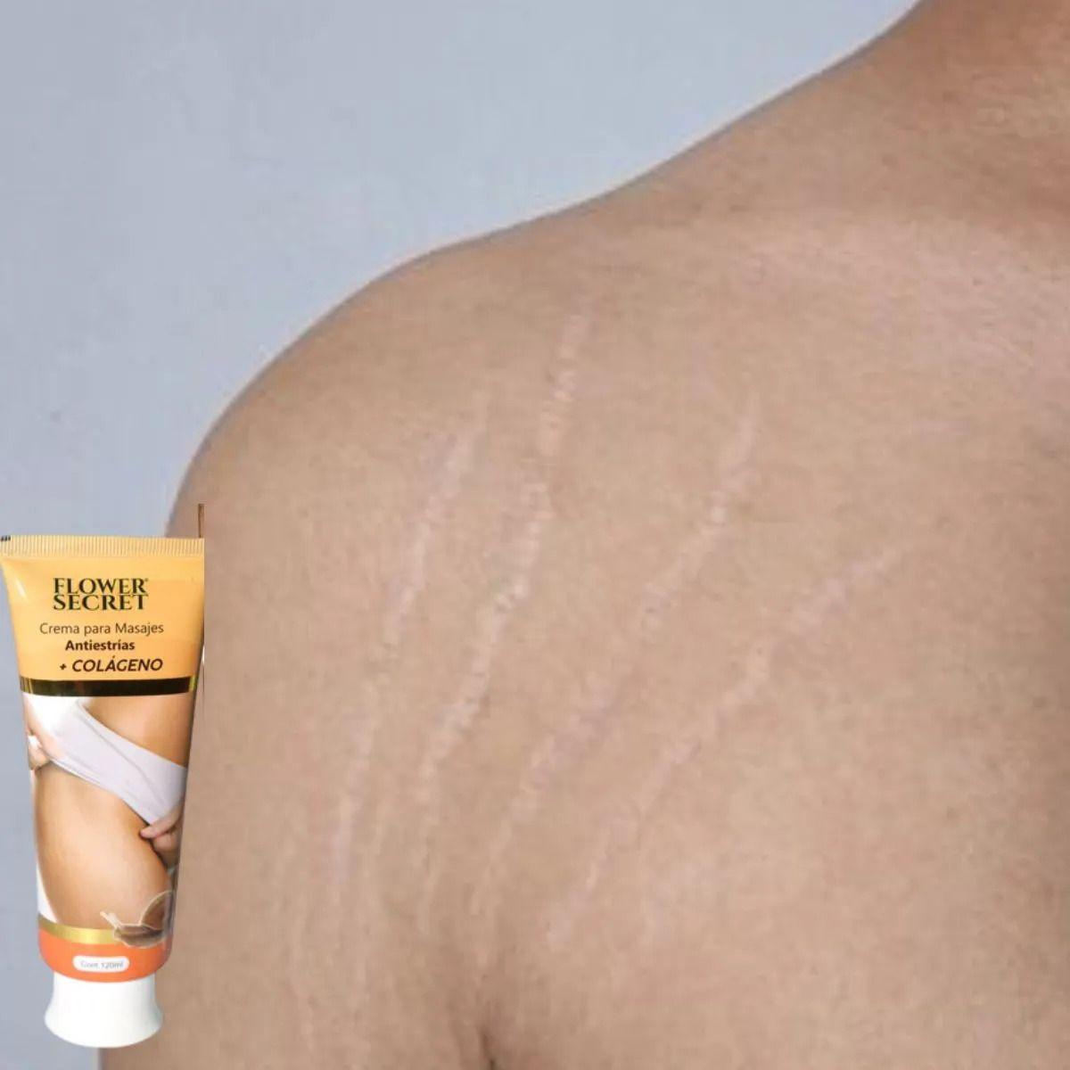 Set 8 Cremas Corporal Antiestrias Colageno Reafirma Lau-7