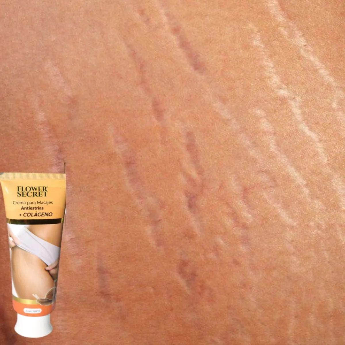 Set 8 Cremas Corporal Antiestrias Colageno Reafirma Lau-9