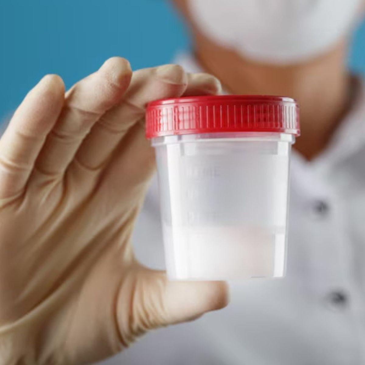 PAQUETE RECOLECTOR DE HECES MUESTRA LABORATORIO LAU-3