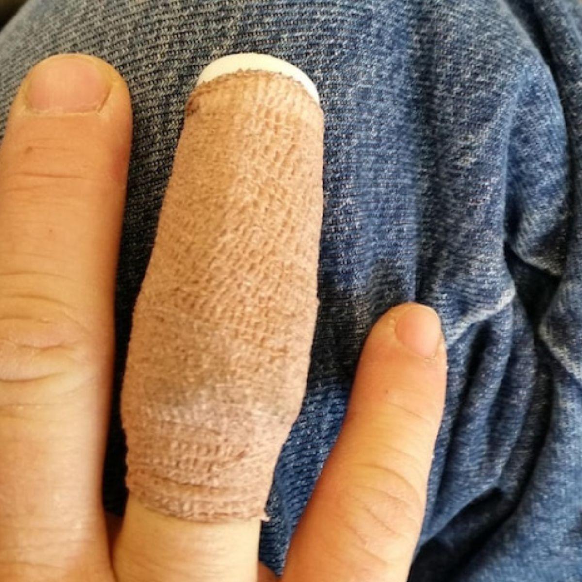 PACK 10 VENDAS ELASTICAS COBAN DEDOS 2,5CMX4,5M LESION LAU-4