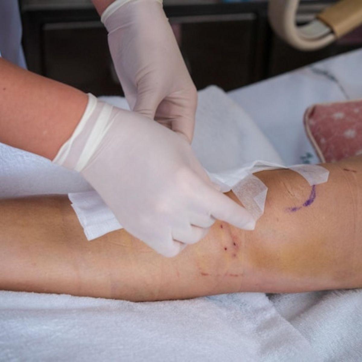 PACK 6 GASAS ESTERIL 90CMX90CM INSUMO MEDICO HERIDA LAU-6