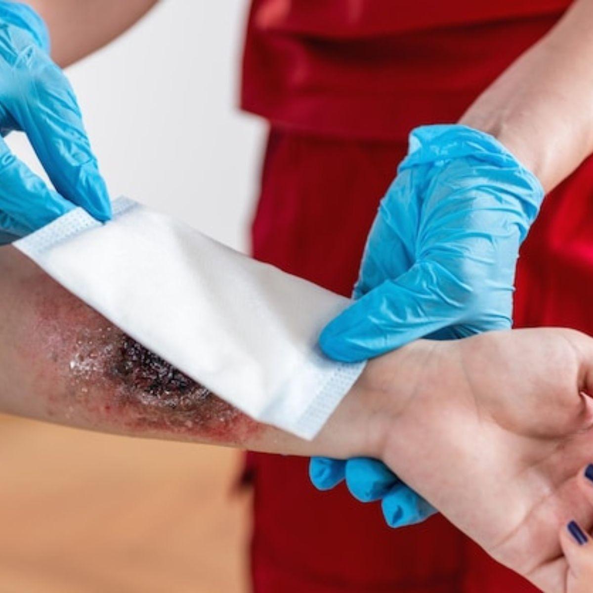 PACK 6 GASAS ESTERIL 90CMX90CM INSUMO MEDICO HERIDA LAU-8