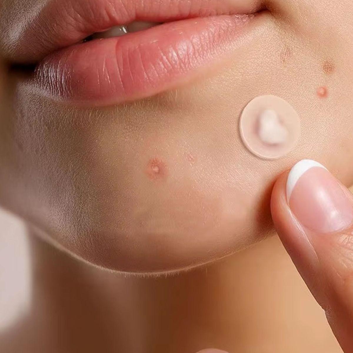 SET 6 PACK PARCHES DE HIDROCOLOIDE PARA CUIDADO VERRUGAS LAU-2