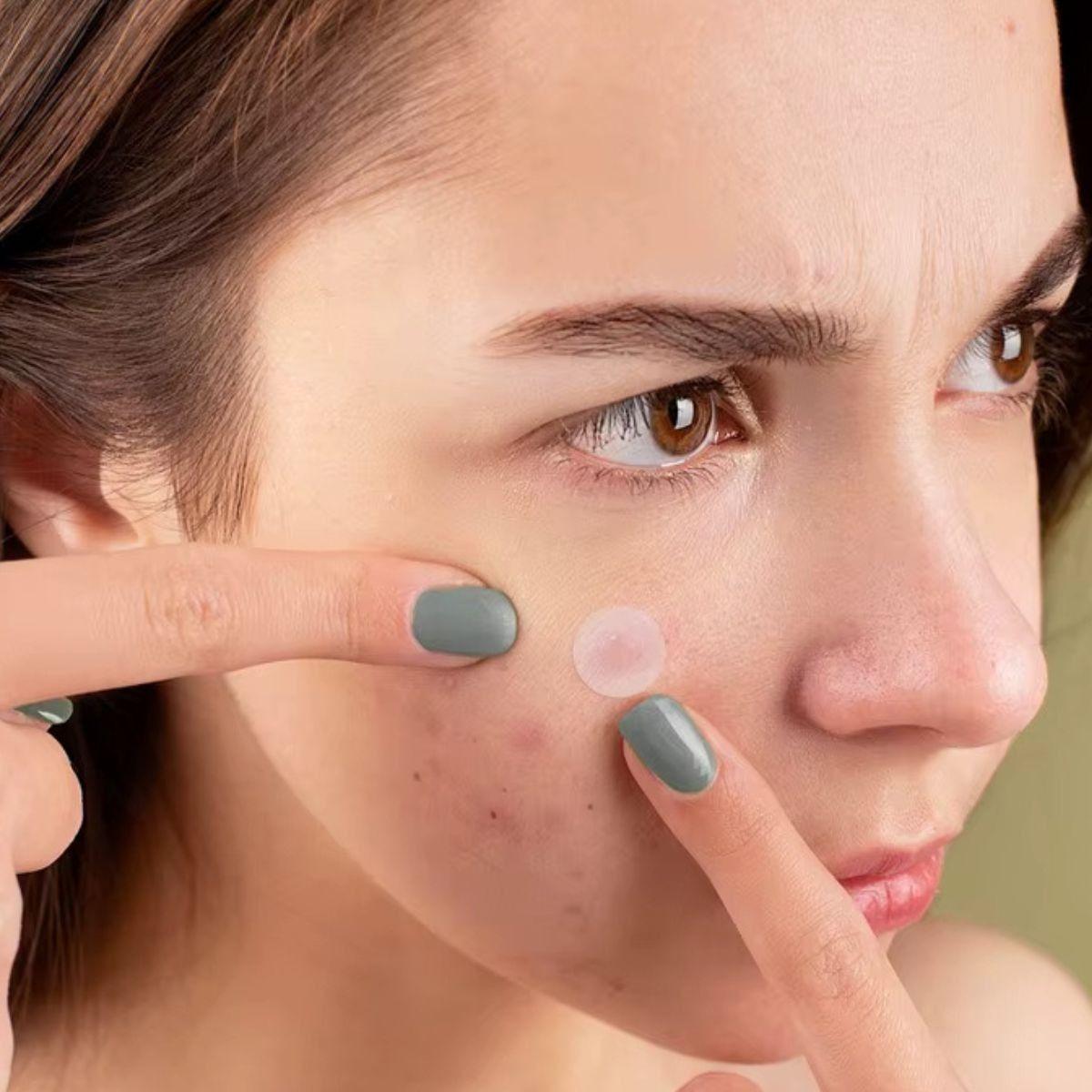 SET 6 PACK PARCHES DE HIDROCOLOIDE PARA CUIDADO VERRUGAS LAU-7