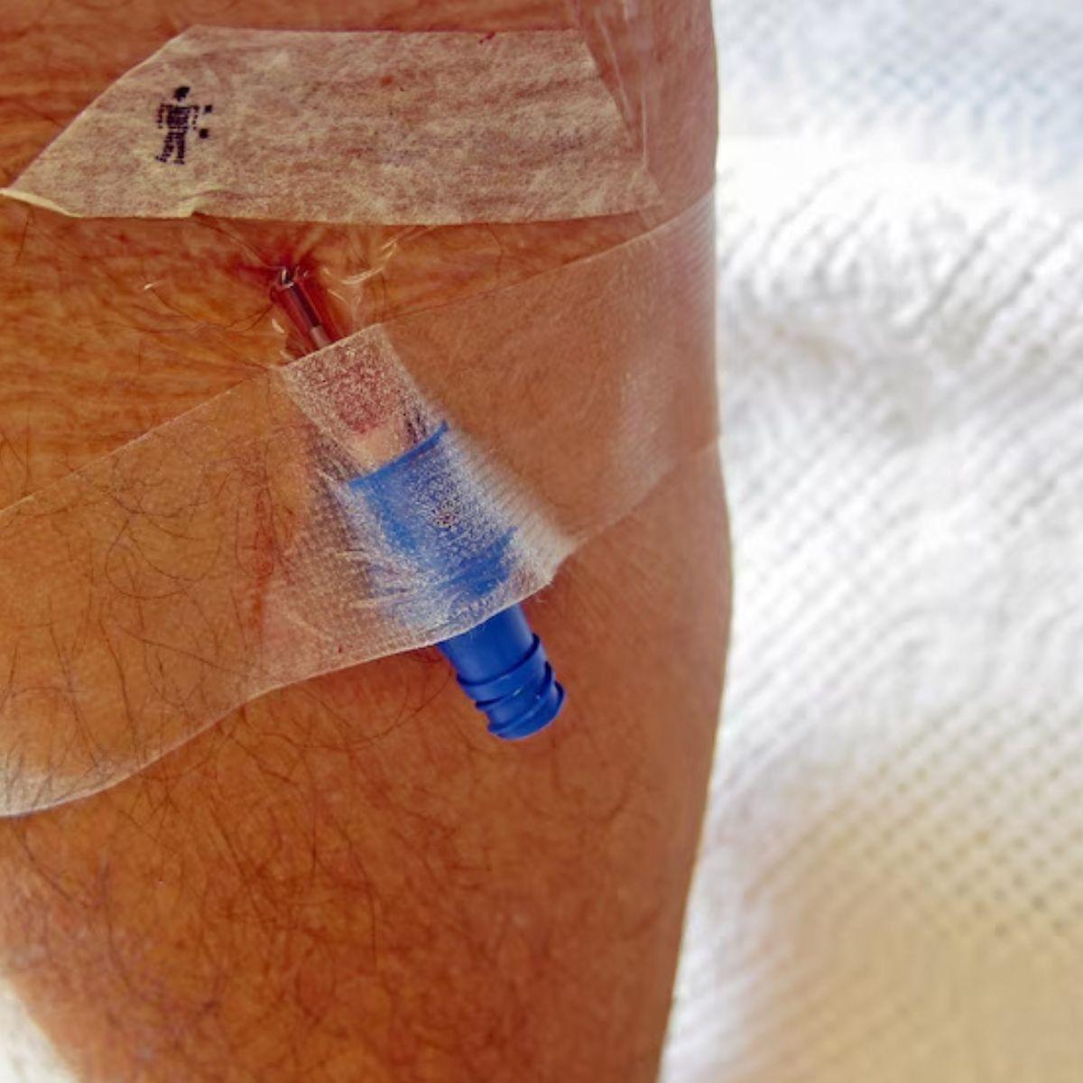 PACK CINTA ADHESIVA PLASTICA USO MEDICO 1,25CMX5M LAU-4