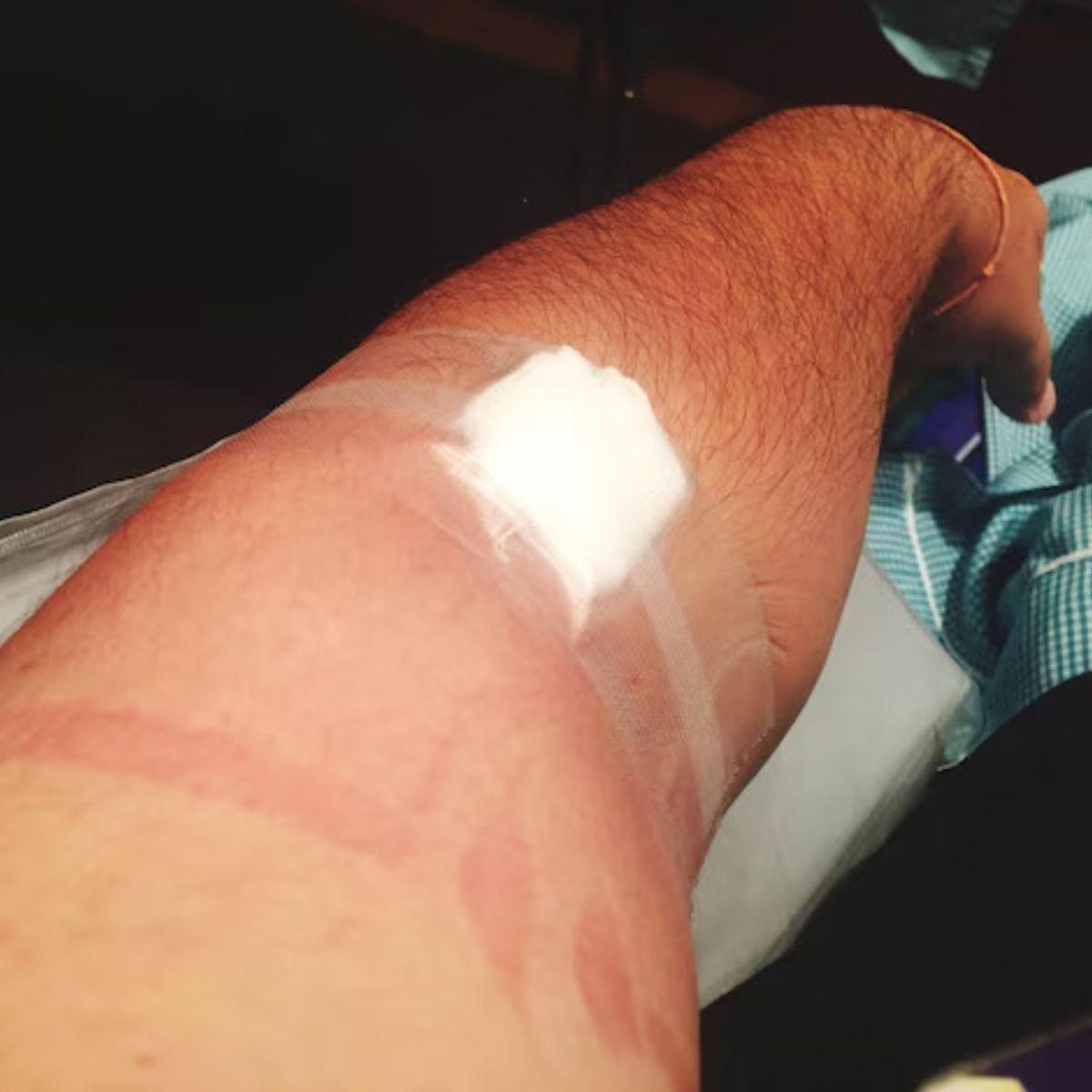 PACK CINTA ADHESIVA PLASTICA USO MEDICO 1,25CMX5M LAU-9