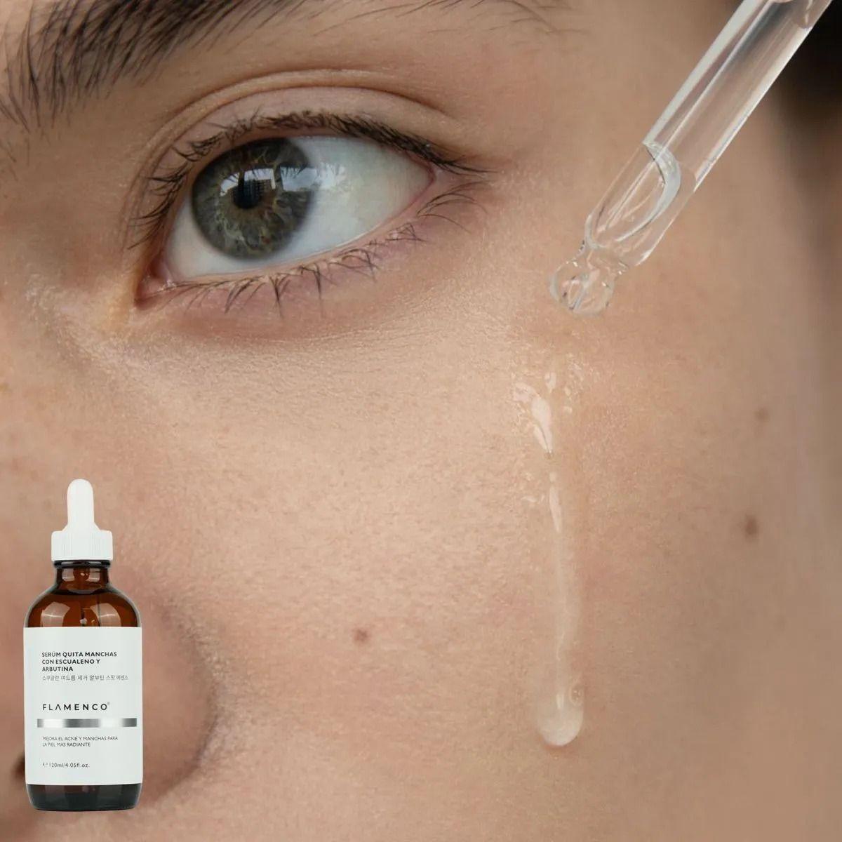 SERUM FACIAL DESPIGMENTANTE ANTIACNE ESCUALENO ARBUTINA LAU-8