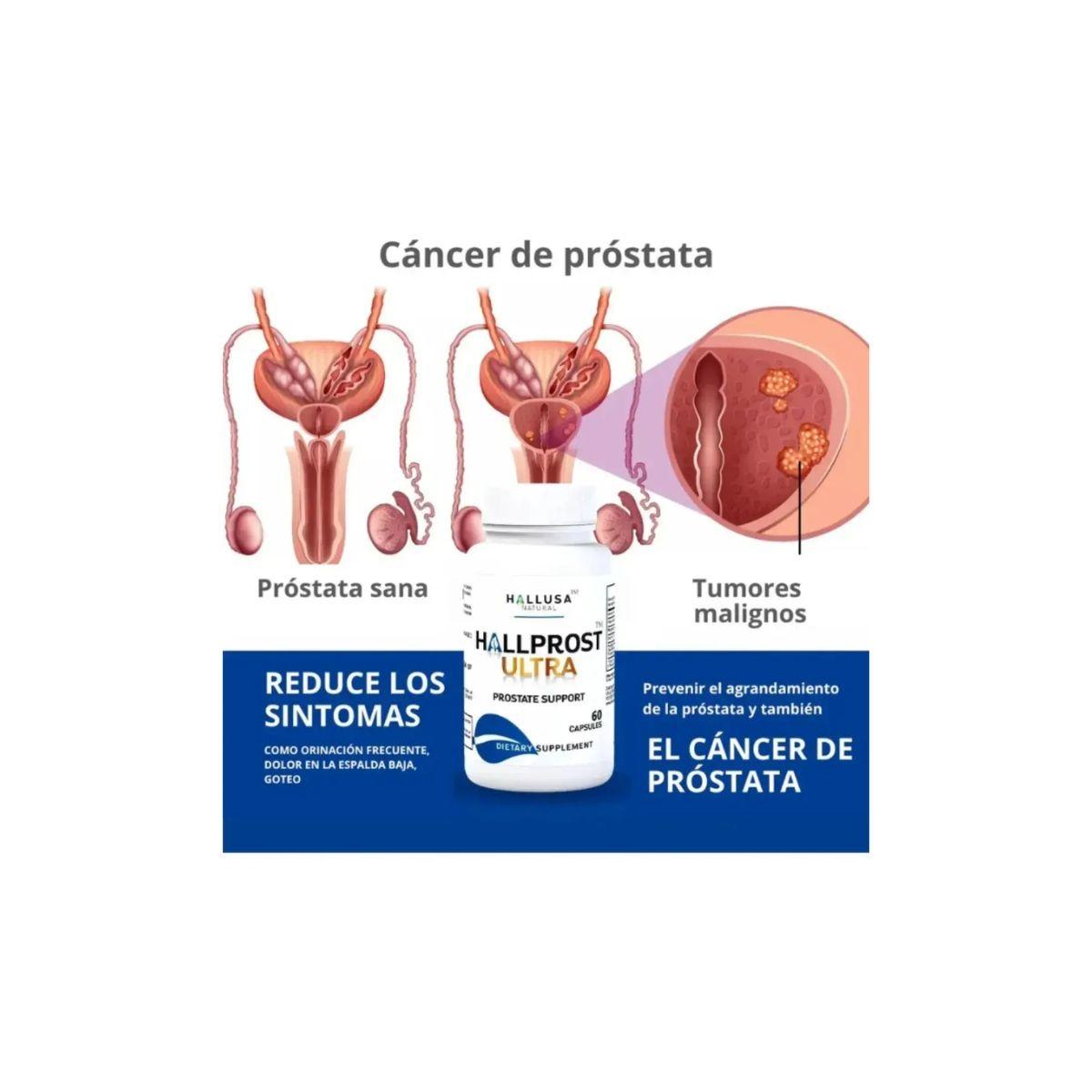 Hallprost Ultra 60 C psulas Concentradas-3