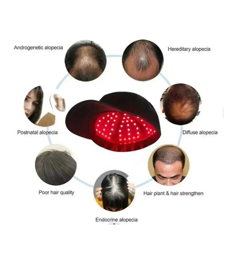 Gorro Terapia Crecimiento Cabello Pelo Alopecia 660nm 850nm-2