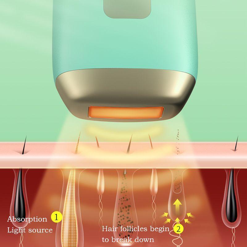 Depiladora IPL 999.999 disparos - Toronto-4