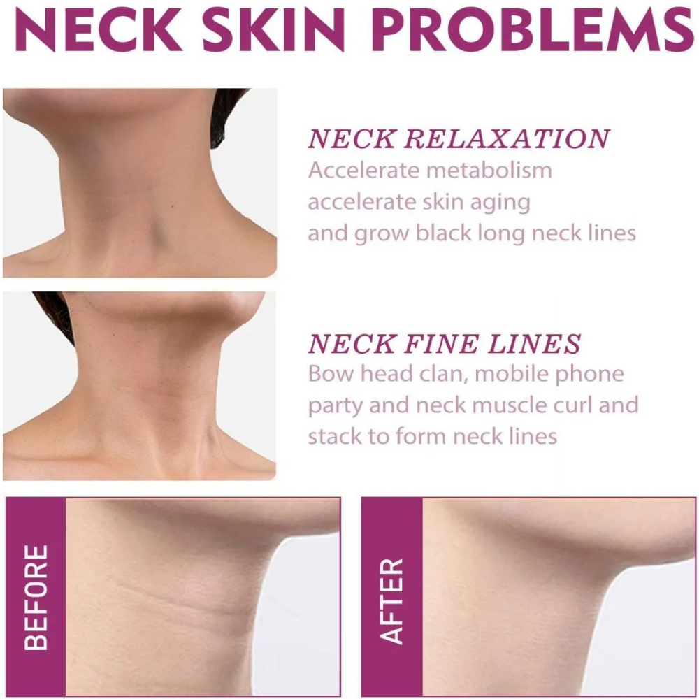 Crema Neckpon Colageno Hidrolizado Reafirmante Cuello Escote 40gr-1
