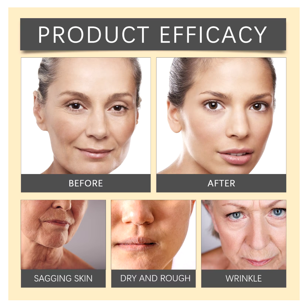Botox Bee Venom Crema Colageno Facial Efecto Lifting 20gr-4