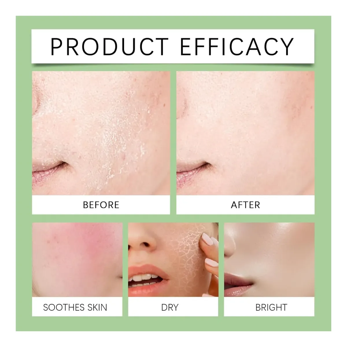 Serum Facial Antiacne Acido Azelaico 10% + Hialuronico Hoygi 30ml-3