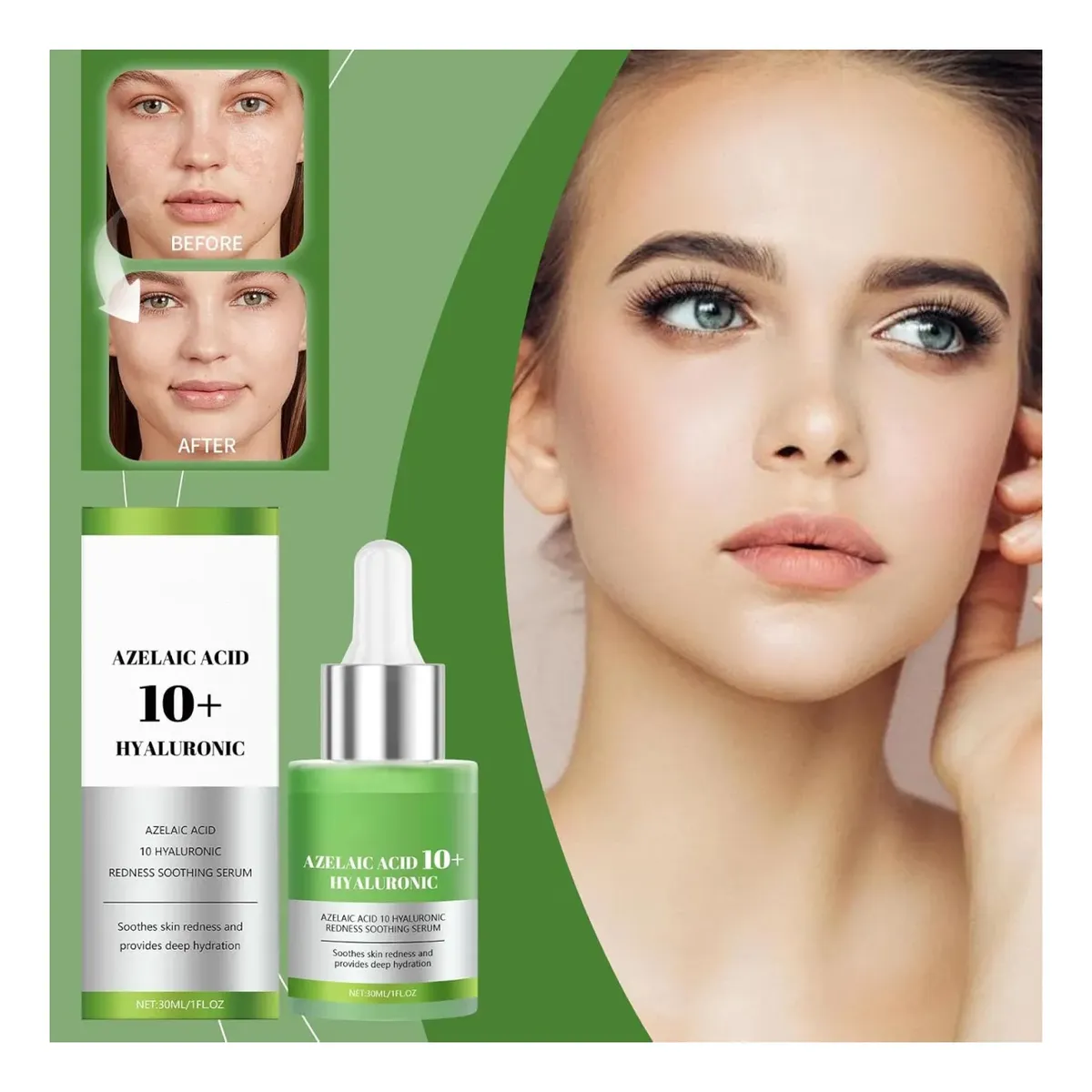 Serum Facial Antiacne Acido Azelaico 10% + Hialuronico Hoygi 30ml-6