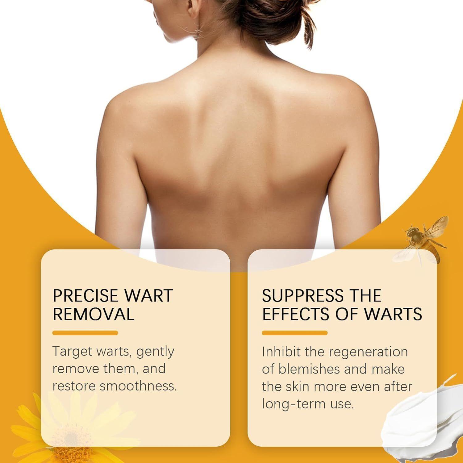 Botox Bee Venom Moles and Warts Crema de Cuerpo y Rostro para Remover Lunares y Verrugas 30gr-2