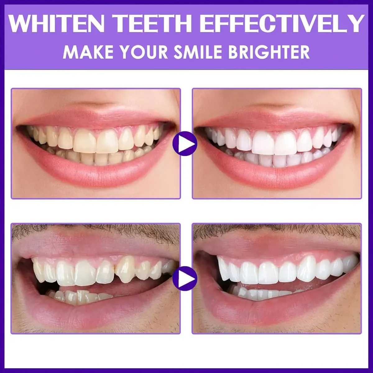 Purple Gel V34 Whitening Booster Pasta Blanqueamiento Dental-4