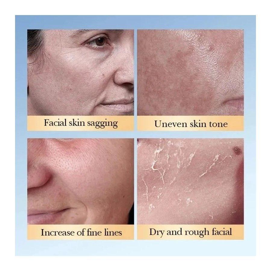 Glycolic Acid 7% Solucion Acido Glicolico + Ceramidas 230ml-2