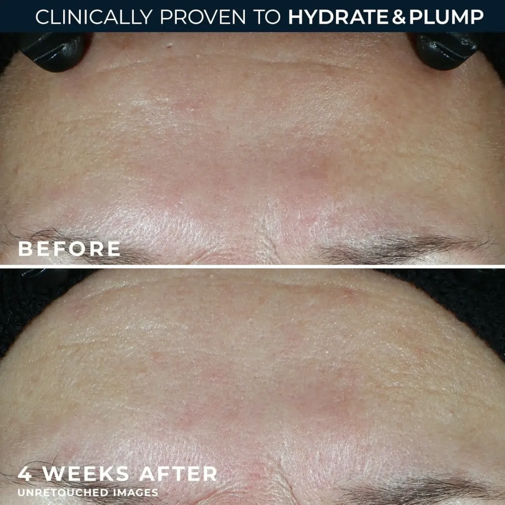 Roc Multi Correxion Hydrate Plump Spf30 Acido Hialuronico 50ML-3