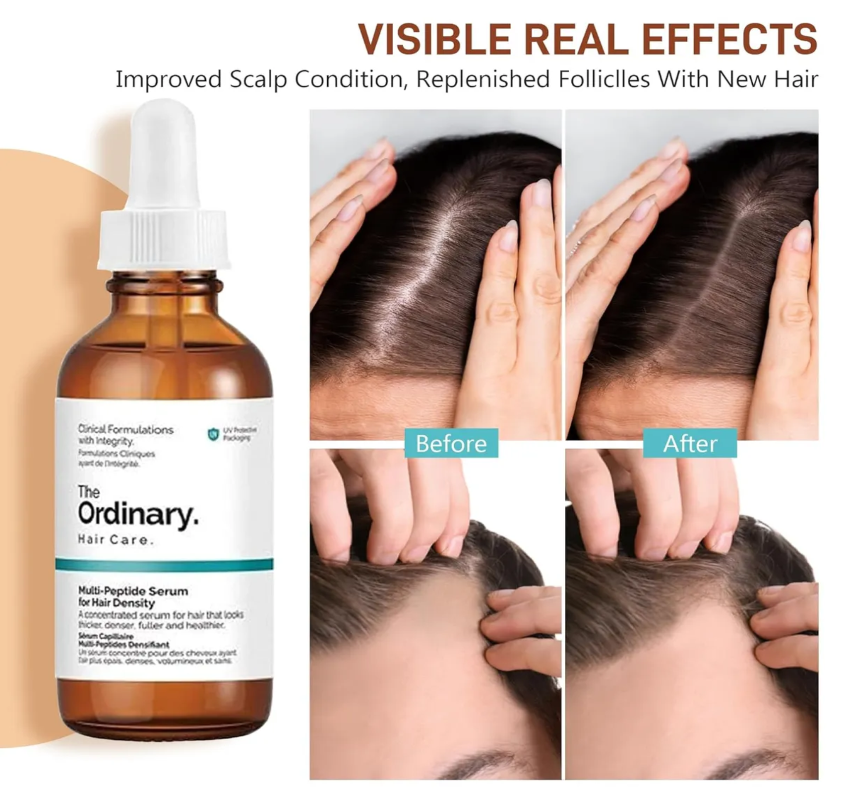 The Ordinary Serum Para Hacer Crecer El Pelo Evitar Su Caida-6