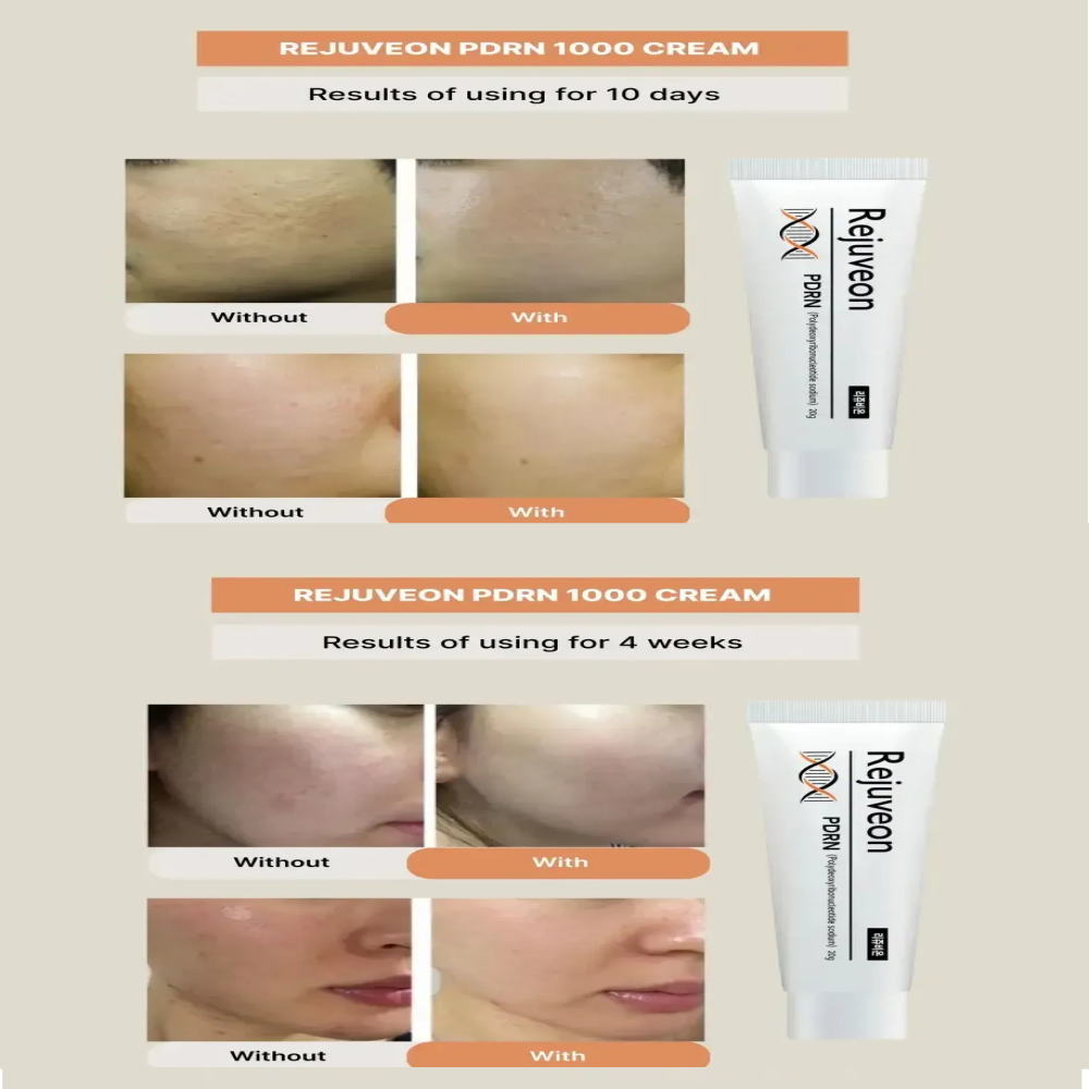 Crema Facial Rejuveon Pdrn 1000 Plus Reparadora Antiedad 20g-6