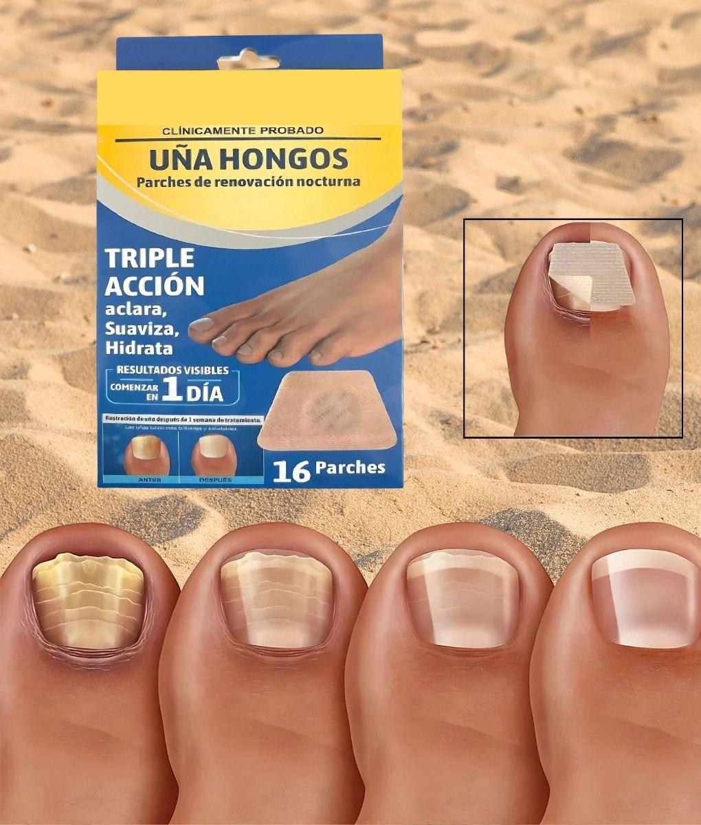 Parche Renovación Nocturna Hongos Uñas Pack Jhn-7