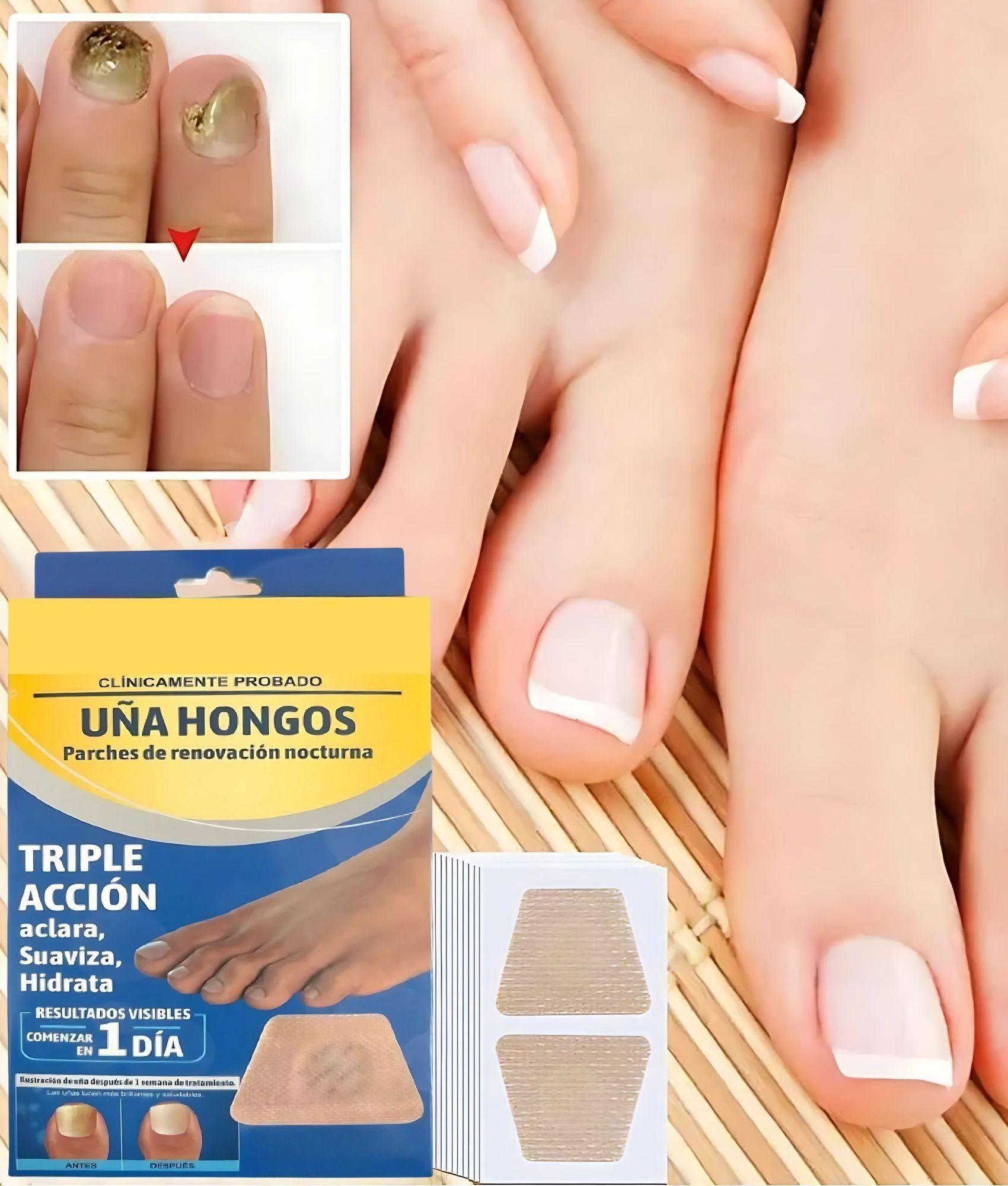 Parche Renovación Nocturna Hongos Uñas Pack Jhn-6