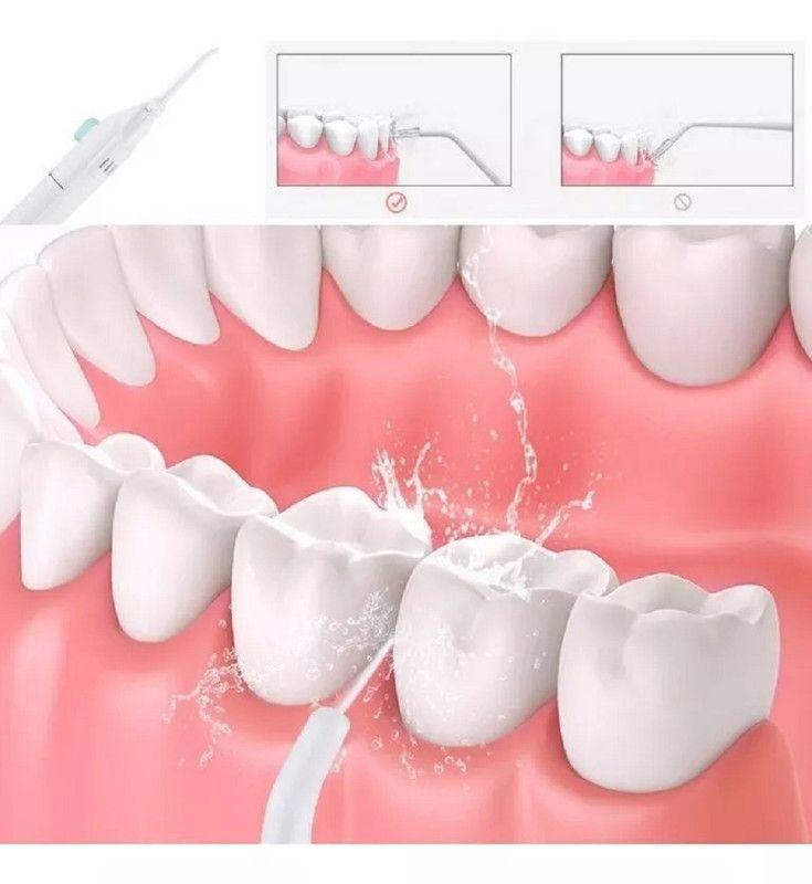 Set 3 Irrigador Limpiador Dental Agua Presión  Brackets Lau-2