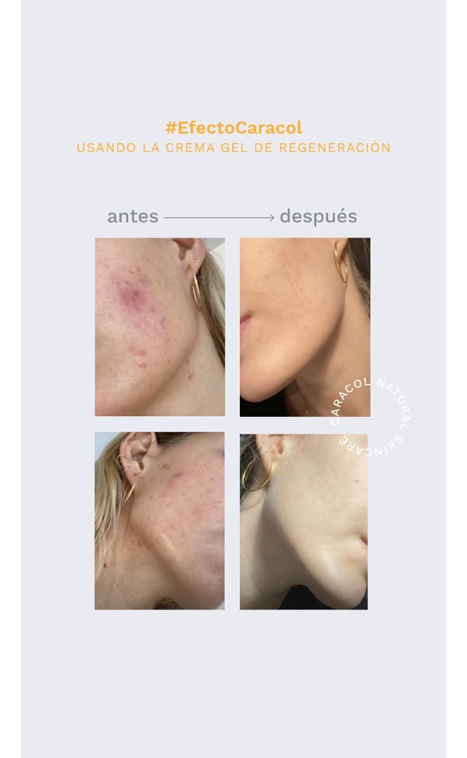 Crema Gel de Regeneración Facial Caracol Natural 50 ml-6