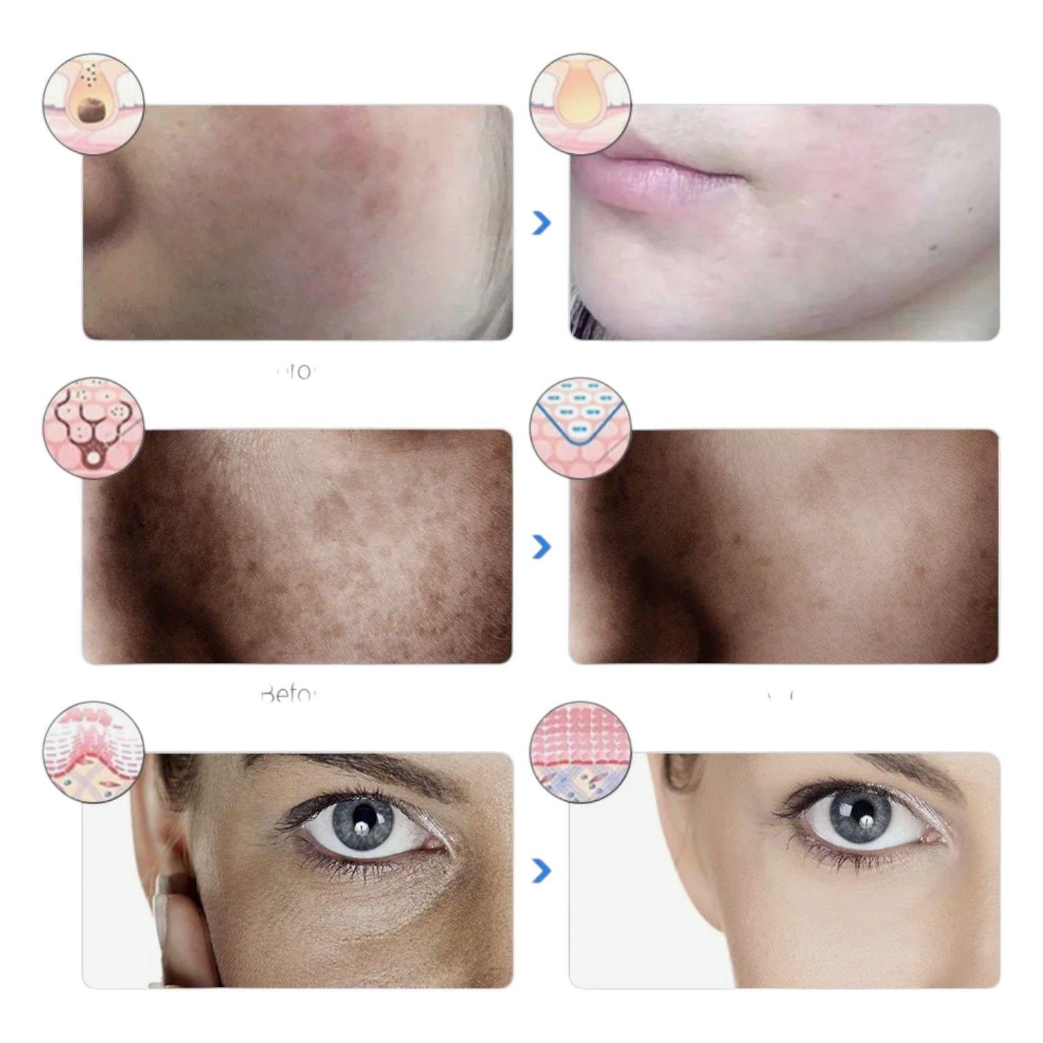 Mascara Facial Microterapia Fotones Led 7 Colores NC03-7