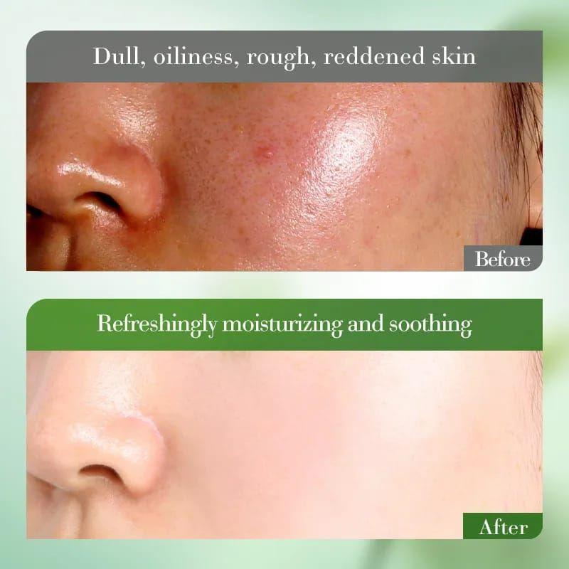 Set Skincare  Kit De Lujo Centella Asiatica 6 pcs-3