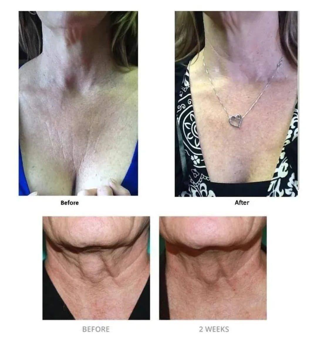 Crema  Antiarrugas Cuello y Escote  Con Colageno-6