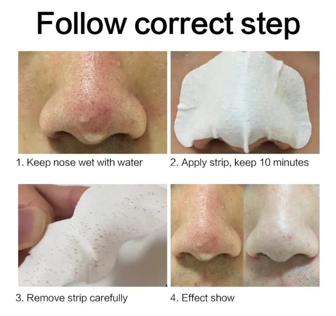 Parches De Limpieza Elimina Puntos Negros-2